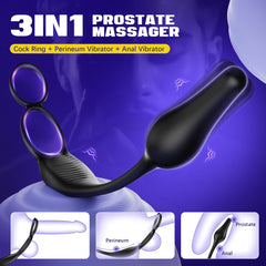 ARCHIE 3 in 1 Prostate Massager Butt Plug with Double Ring